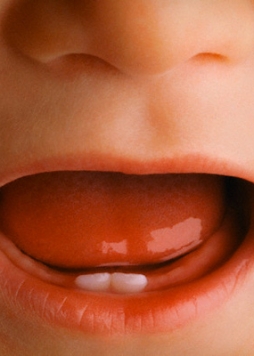 Những điều cần đặc biệt chú ý khi con thay răng