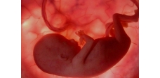 Tìm hiểu hội chứng hạn chế phát triển bào thai