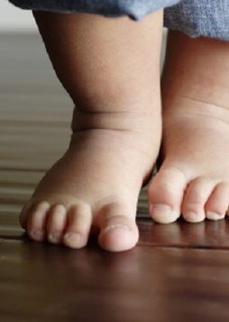 Trẻ chậm biết đi do nhiều nguyên nhân